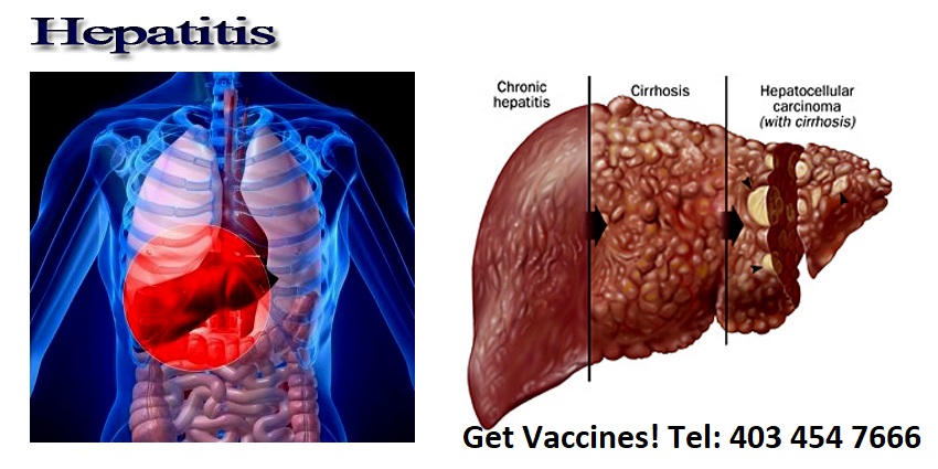 New Brighton Remedys Pharmacy & Travel Clinic | 151 Copperpond Blvd SE, Calgary, AB T2Z 0Z7, Canada | Phone: (403) 453-3363
