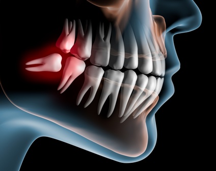 Southwestern Oral & Maxillofacial Surgical Centres | 860 Tecumseh Rd E #200, Windsor, ON N8X 4E7, Canada | Phone: (519) 258-1231