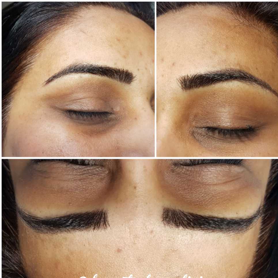 Dermatec Permanent Cosmetic and Laser Clinic | 6499 122a St, Surrey, BC V3W 3R8, Canada | Phone: (604) 805-4273