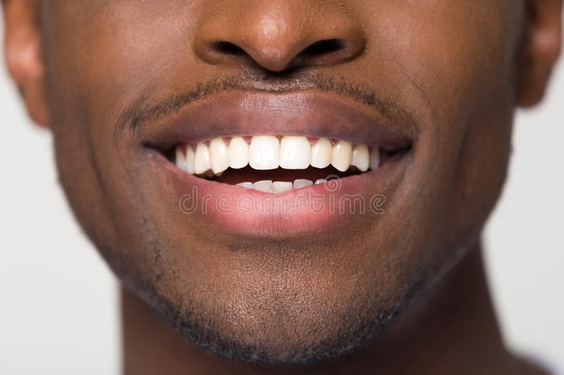 Pierre Arbour Dentiste | 4915 Rue de Salaberry Suite 100, Montréal, QC H4J 1H8, Canada | Phone: (514) 336-6339