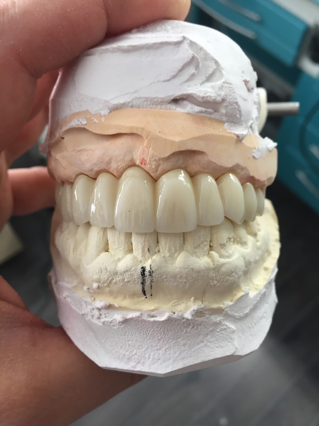 Chois Dental Studio | 1270 King St E, Cambridge, ON N3H 3P8, Canada | Phone: (289) 788-3996