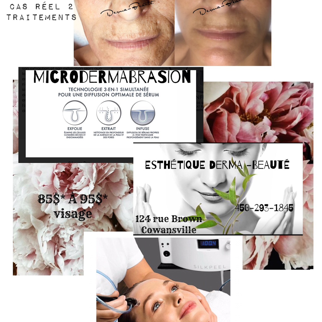 Esthétique Derma-beauté | 124 Rue Brown #1, Cowansville, QC J2K 2A9, Canada | Phone: (450) 293-1845