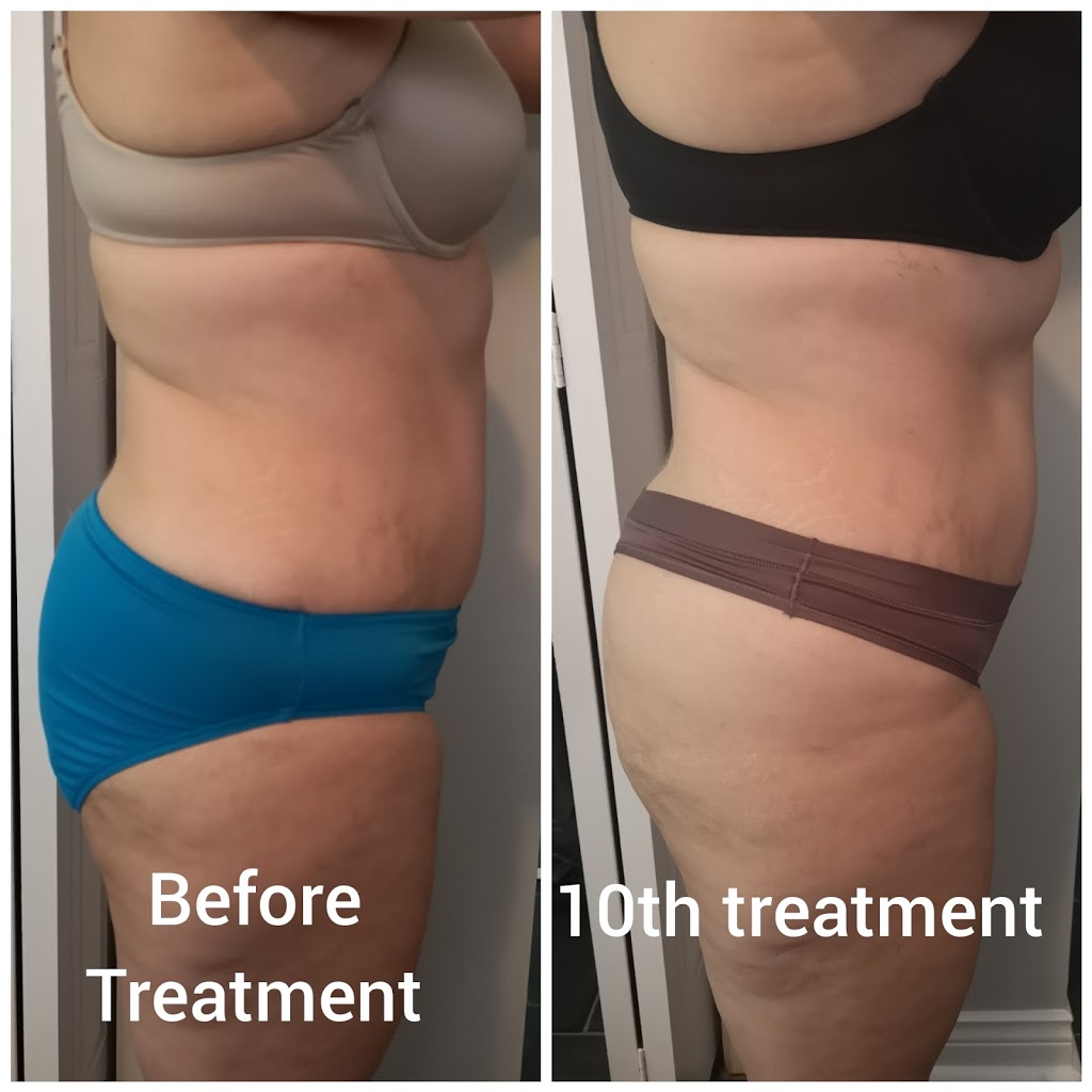 The New You Beauty Studio | 120 Glenroy Crescent, London, ON N5Z 4H7, Canada | Phone: (519) 630-5544