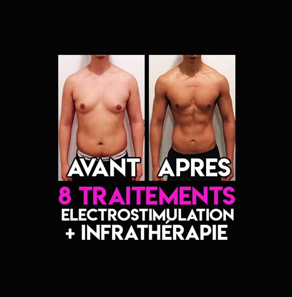 Electrostimulation rive-sud | 87-d Rue St Pierre, Saint-Constant, QC J5A 1G7, Canada | Phone: (514) 730-8423