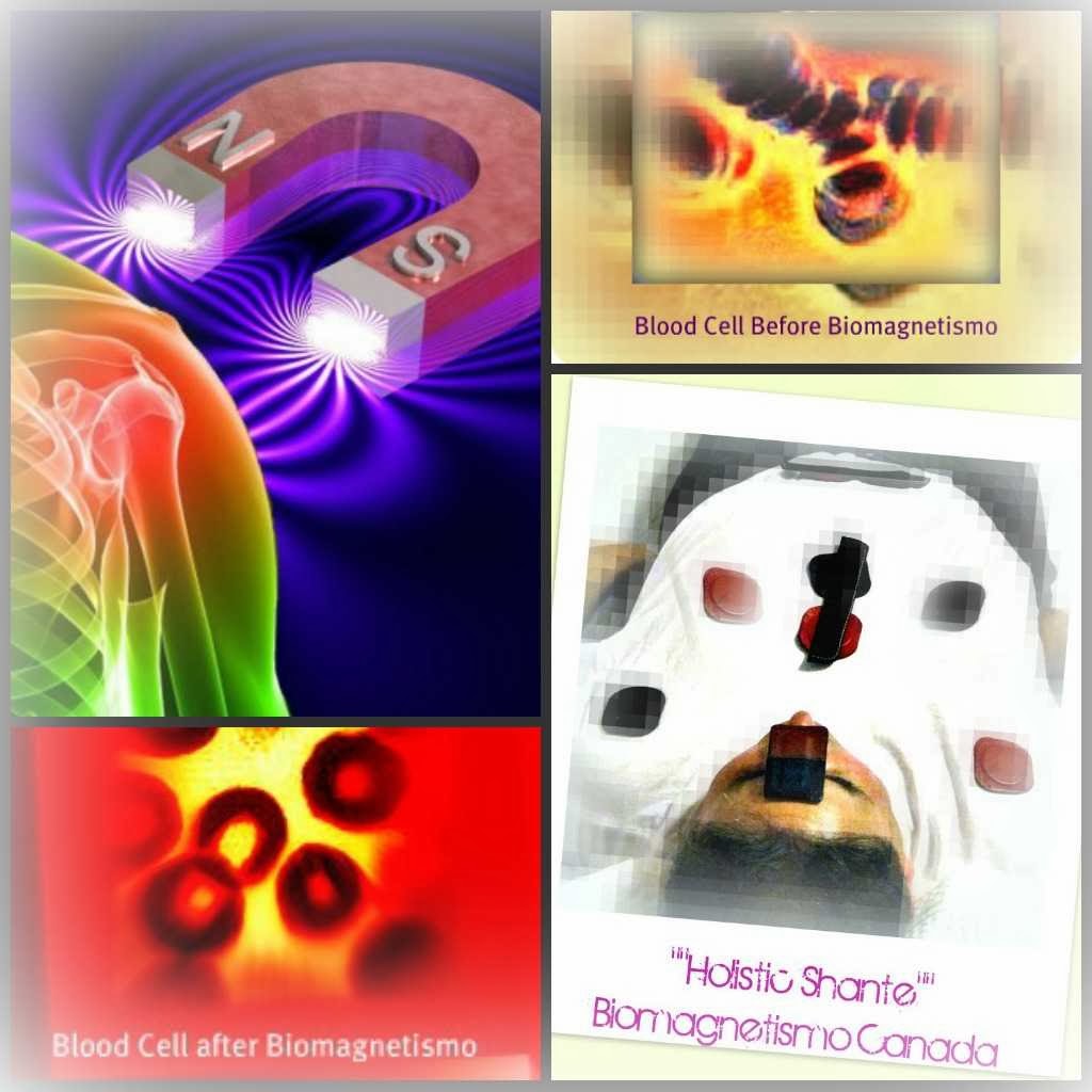 Biomagnetismo.reiki "Holistic Shante" | 3236 Strabane Dr, Mississauga, ON L5C 1W7, Canada | Phone: (905) 566-5569