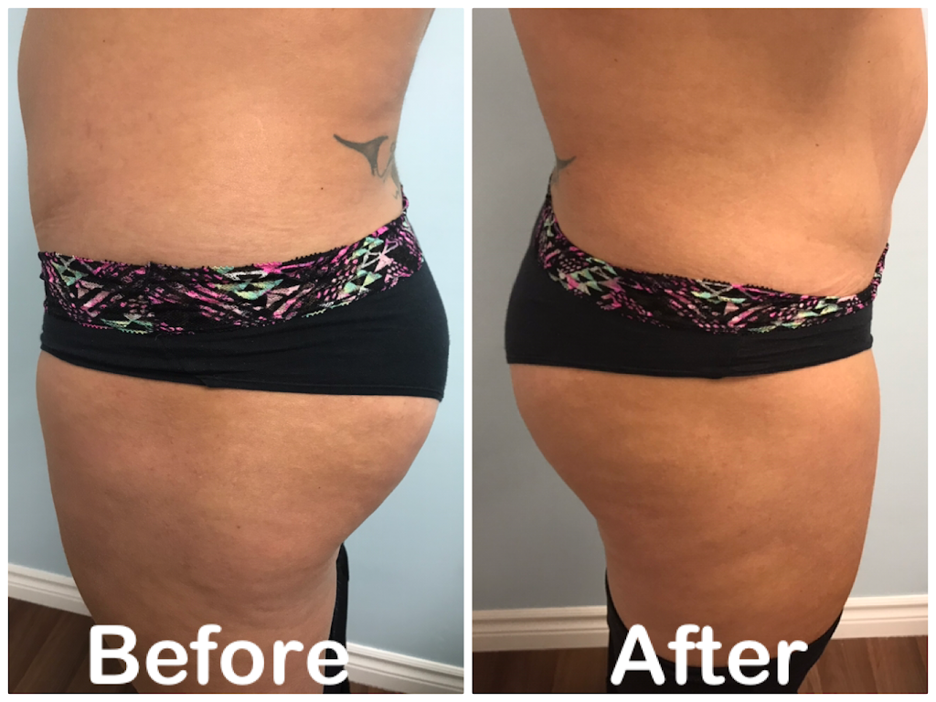 Adam & Eve inc. Total Body Perfection | 8 Glenda Rd, Scarborough, ON M1M 2H4, Canada | Phone: (416) 266-1717