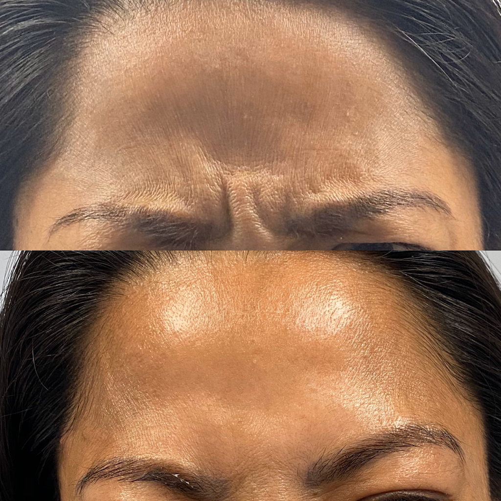 Enhanced Medical Aesthetics | Edmonton | St. Albert | 1115 St Albert Trail, St. Albert, AB T8N, Canada | Phone: (587) 404-8813