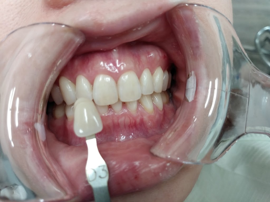 Zoom Dental Burnaby | 6968 Royal Oak Ave #105, Burnaby, BC V5J 4J3, Canada | Phone: (604) 258-0392