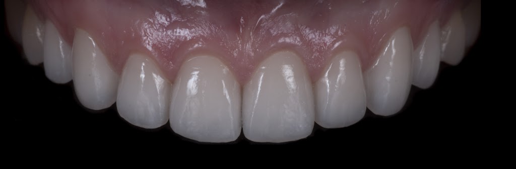 Krest Dental Ceramics | 45 Research Rd, East York, ON M4G 2G8, Canada | Phone: (416) 467-6674