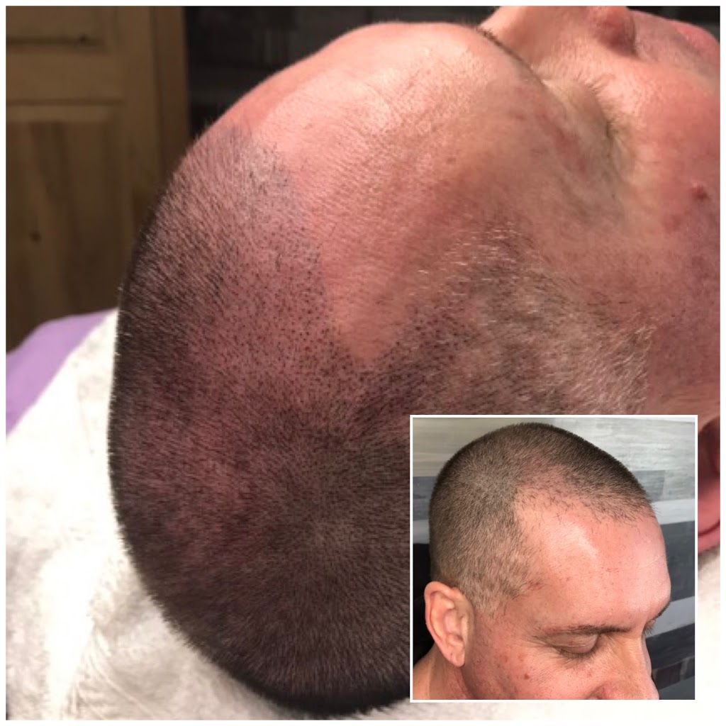 Micropigmentation Capillaire & Maquillage Permanent Marie-Josée  | 4096 Rue des Thuyas bureau 1, Québec, QC G1G 0G6, Canada | Phone: (418) 573-7154