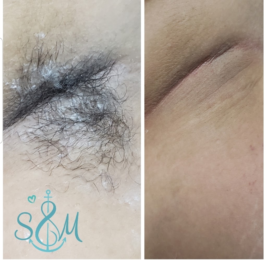 Sugaring & Massage Spalon Inc. A Studio for Men and Women. | 3038 Hurontario St #1, Mississauga, ON L5B 3B9, Canada | Phone: (905) 949-4944