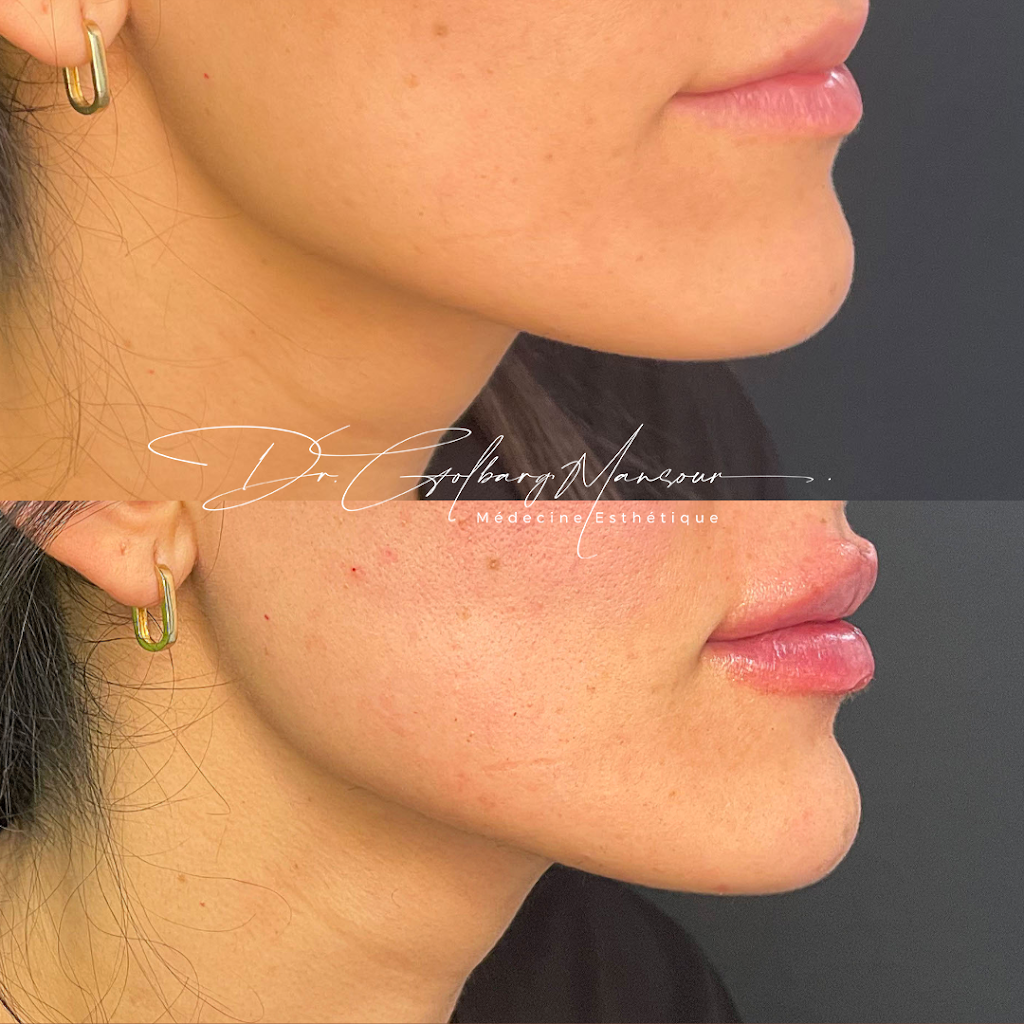 Clinique Esthétique HoMa - Dr. Golbarg Mansour | 4514 Rue Sainte-Catherine E, Montréal, QC H1V 1Y5, Canada | Phone: (514) 500-5805