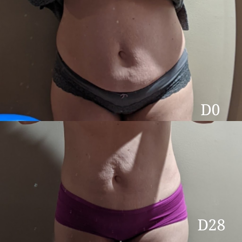 Rosewood_Aesthetics_Clinic | 3670 63 Ave NE, Calgary, AB T3J 0G7, Canada | Phone: (403) 798-7447