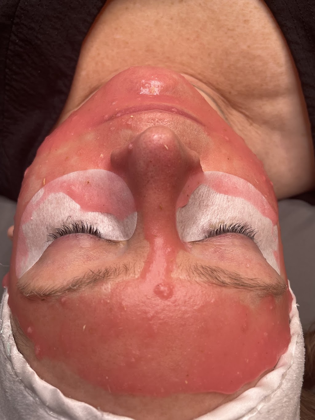 Diamond J Esthetics | Airdrie, AB T4B 0G9, Canada | Phone: (403) 465-0817