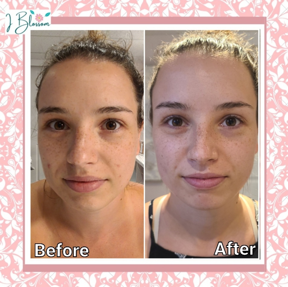 I Blossom Skincare | 119 Nash Rd S, Hamilton, ON L8K 4J8, Canada | Phone: (519) 321-0897