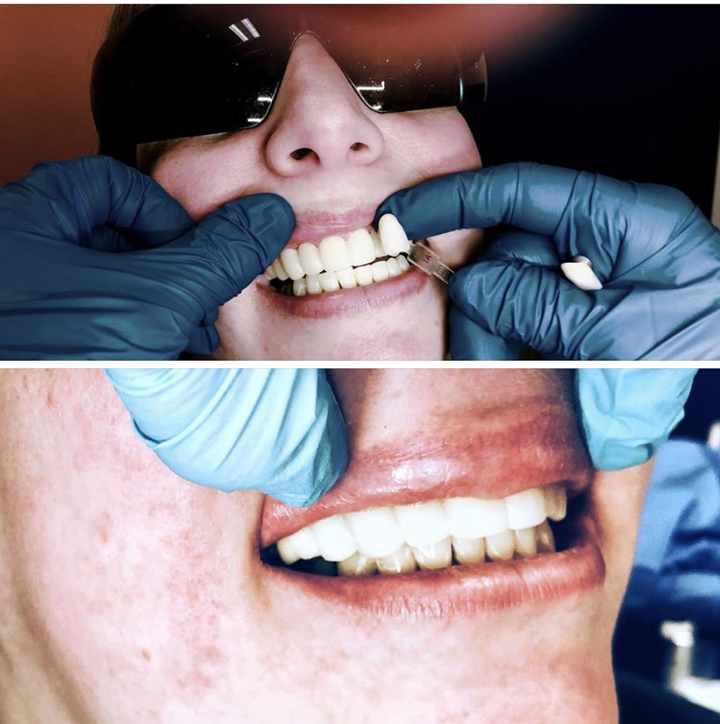 Bellwether Dental | 12 Bellwether Way #112, Bellingham, WA 98225, USA | Phone: (360) 366-8026