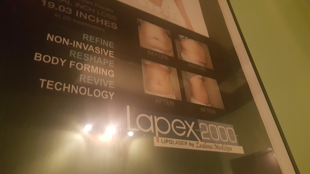 Zealous Medi Spa | 390 Provencher Blvd, Winnipeg, MB R2H 0H1, Canada | Phone: (204) 415-3159