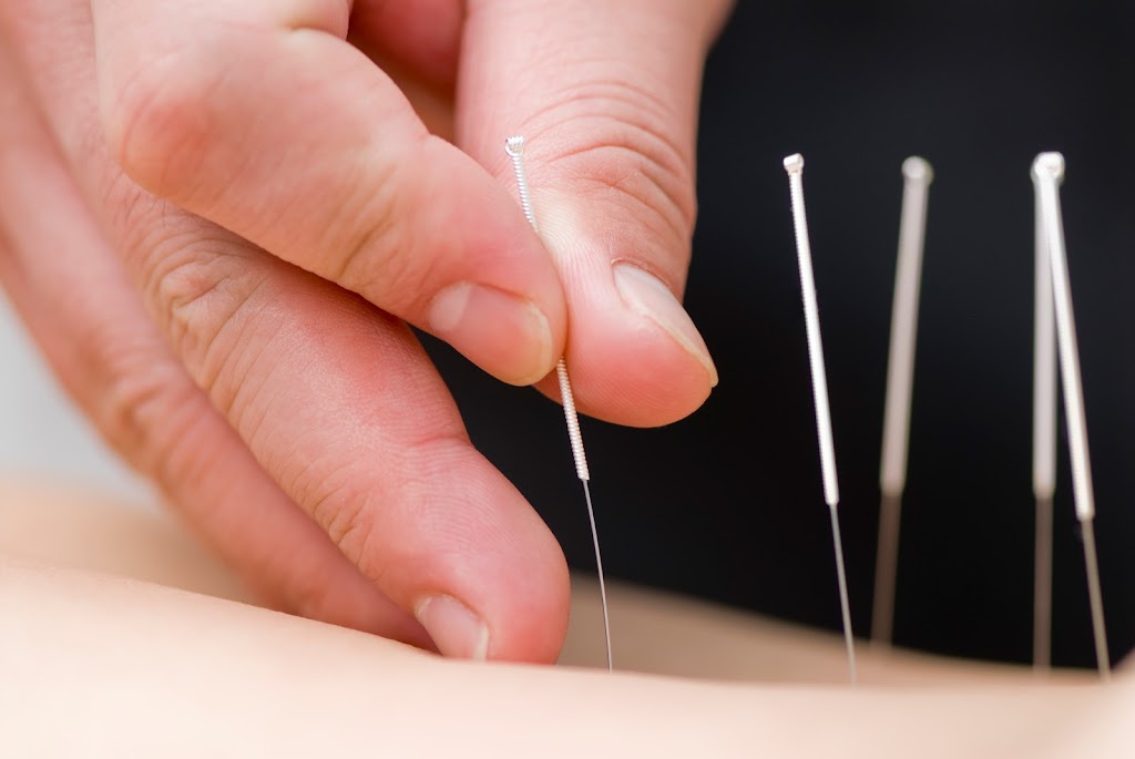 Acupuncture Maca | 3180 Chem. de Chambly #305, Longueuil, QC J4L 1N6, Canada | Phone: (450) 693-0796
