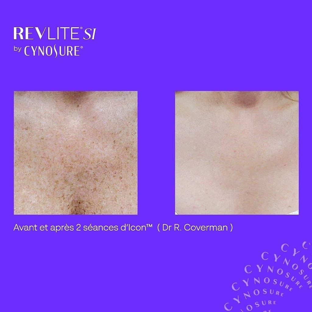 Dermal Essence | 44 Terr. Bellerive, Lavaltrie, QC J5T 1A6, Canada | Phone: (819) 470-8094