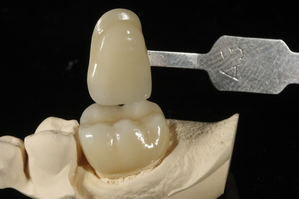 Advanced Implant Solutions | 6935 120 St #203, Delta, BC V4E 2A8, Canada | Phone: (604) 449-7626
