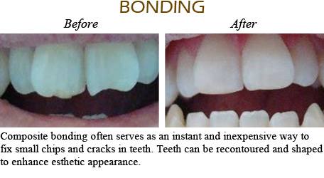 Dentistry On 10 | 3355 Hurontario St Unit 10, Mississauga, ON L5A 4E7, Canada | Phone: (905) 455-9262