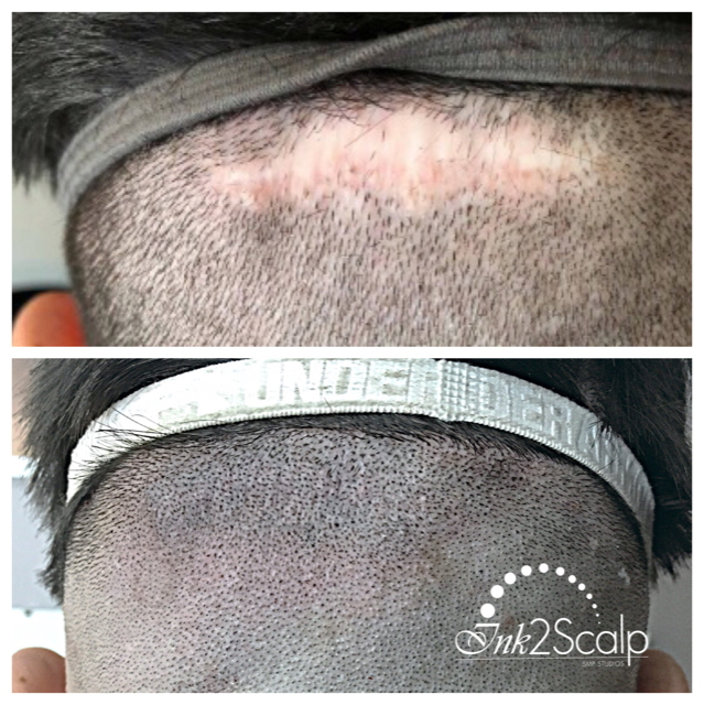 Ink2scalp | 6 Teardrop Crescent, Whitby, ON L1M 2N9, Canada | Phone: (905) 259-1251