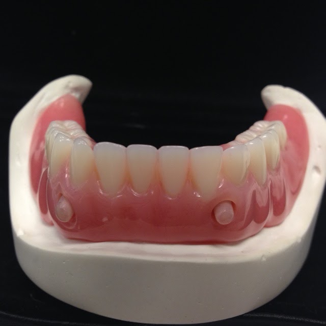 Clinique de denturologie Solutions Sourire | 569 Rue Fabrice, Laval, QC H7P 3C3, Canada | Phone: (450) 622-0404