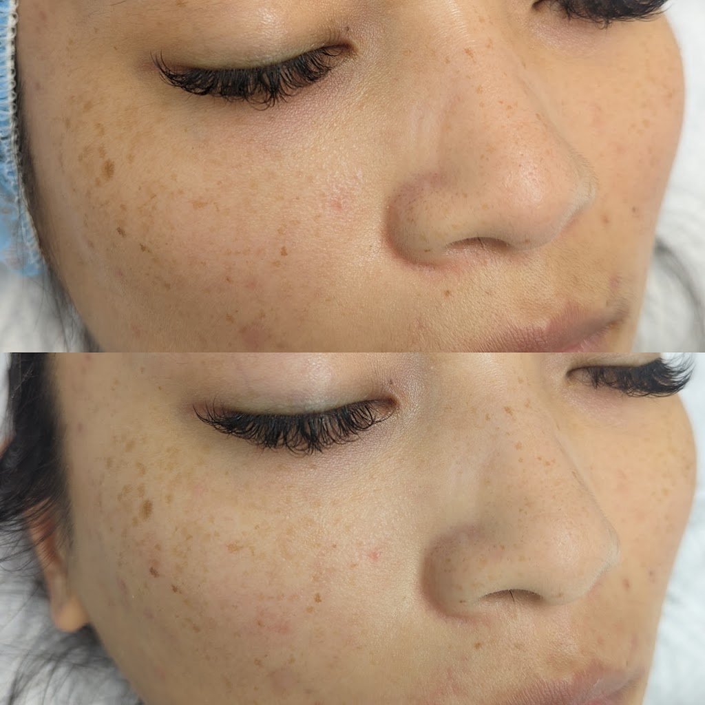 Rosewood_Aesthetics_Clinic | 3670 63 Ave NE, Calgary, AB T3J 0G7, Canada | Phone: (403) 798-7447