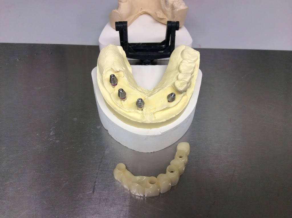 Proceram Dental Arts | 203-34654 Delair Rd, Abbotsford, BC V2S 2C9, Canada | Phone: (604) 853-7793