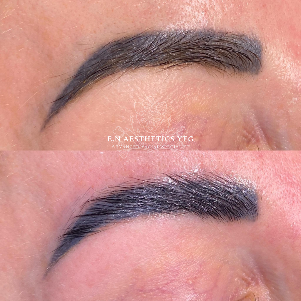Lunar Medical Aesthetics | 31 Kingsbury Cir, Spruce Grove, AB T7X 0C9, Canada | Phone: (780) 920-9981
