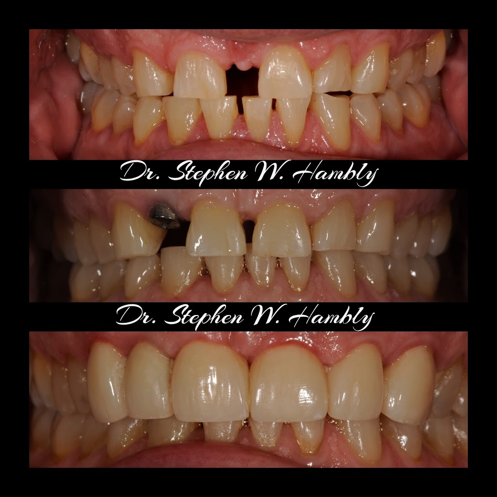 Ancaster Dental Care | 34 Stone Church Rd Suite 202, Ancaster, ON L9K 1S5, Canada | Phone: (905) 304-3479