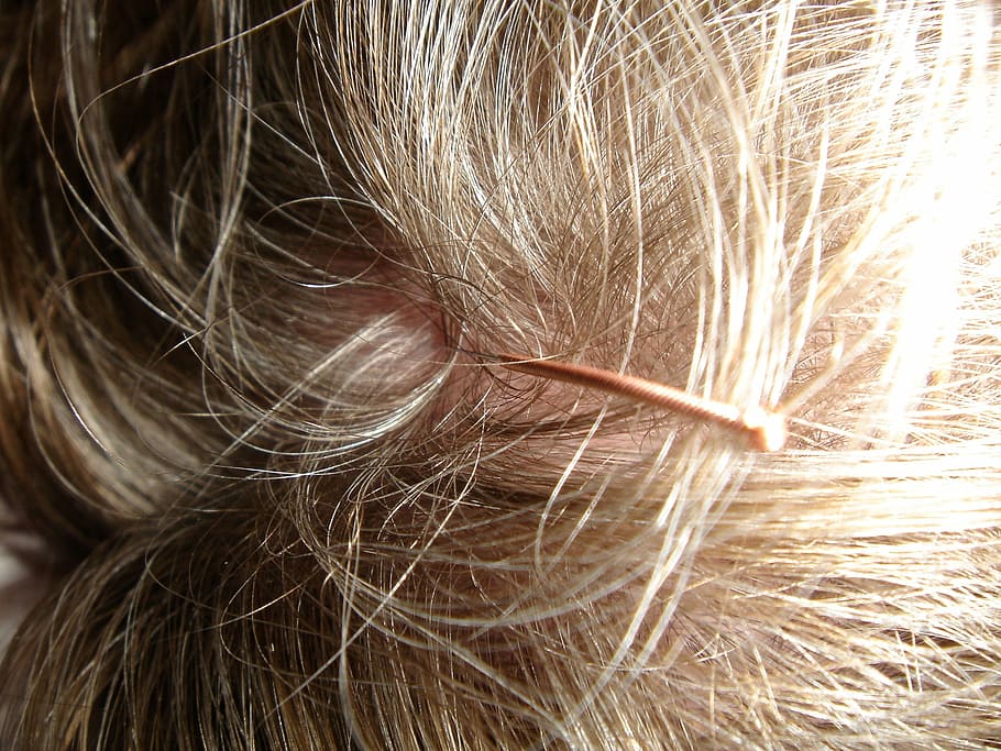Acupuncture Sophie MacKay- Loiselle | Mon Acu - Rosemont | 4453 Rue Beaubien E, Montréal, QC H1T 1T3, Canada | Phone: (514) 476-0611