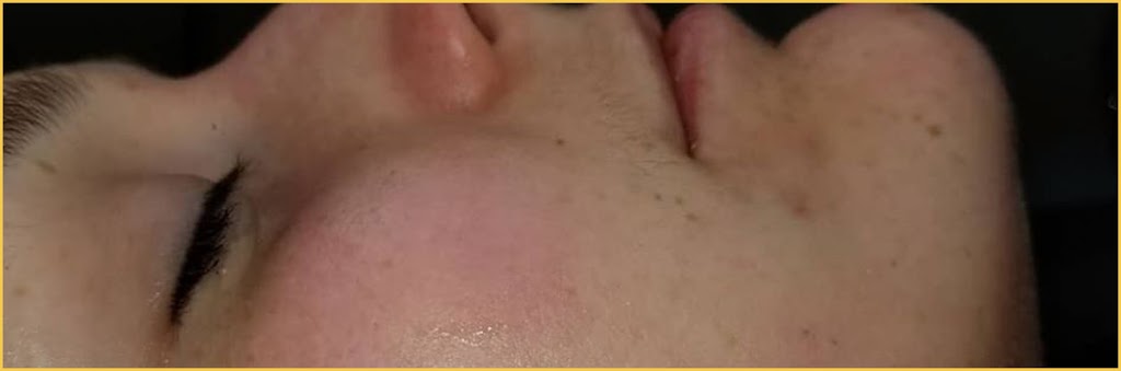 Awaken HydraFacial Windsor | 3926 Concession Rd 6, Windsor, ON N9G 2H4, Canada | Phone: (226) 777-6645