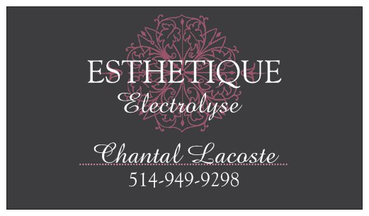 Esthétique Saint-Amable | 446 Rue Marjolaine, Saint-Amable, QC J0L 1N0, Canada | Phone: (514) 949-9298