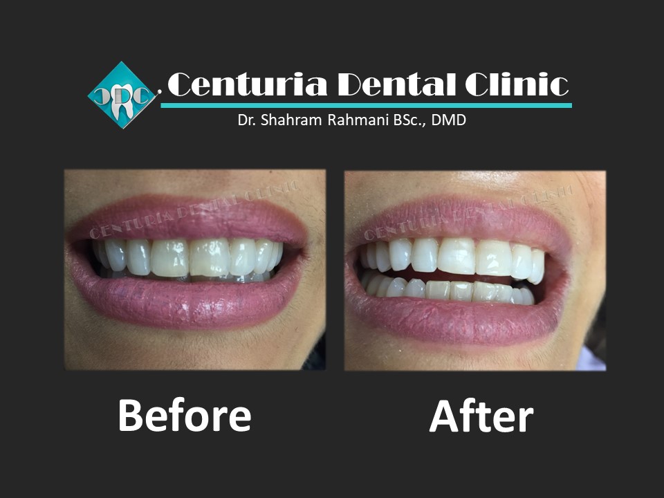 Centuria Dental Clinic | 5-1131 Lawson Ave, Kelowna, BC V1Y 6T8, Canada | Phone: (236) 420-0210