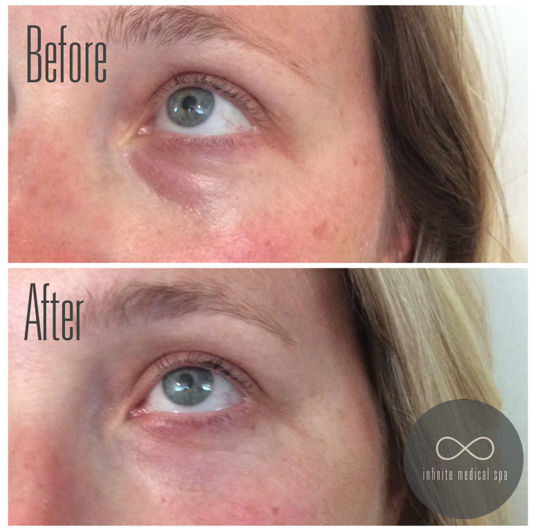 Infinite Medical Spa | 551 Oxford St W Unit 201, London, ON N6H 0H9, Canada | Phone: (519) 709-6494