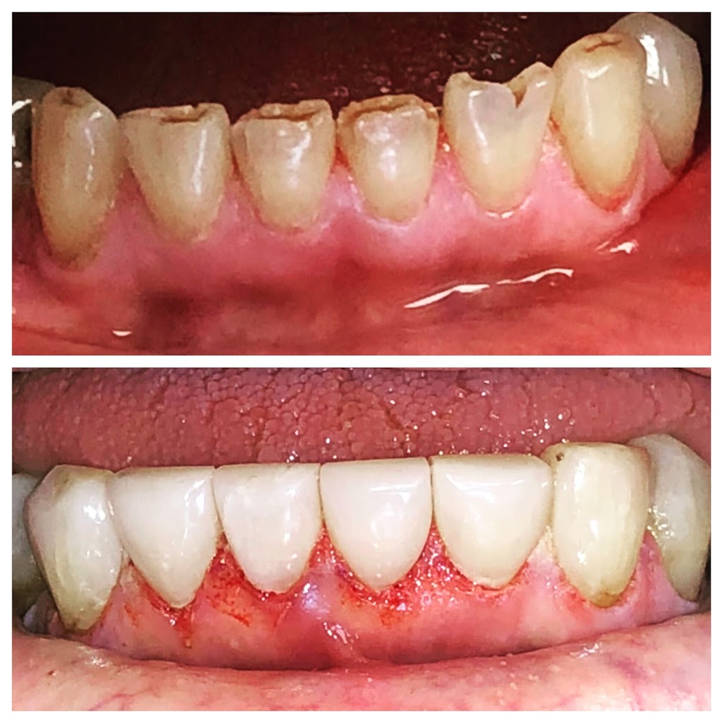 Dental Team on 118 | Main Floor, 4408 118 Ave NW, Edmonton, AB T5W 1A7, Canada | Phone: (780) 471-4801