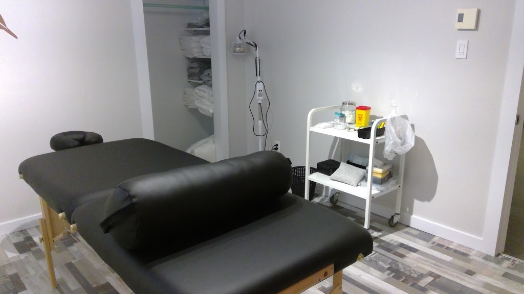 Acupuncture Nancy Sarrazin | 1017 Rue Charles Garnier, Drummondville, QC J2B 2H5, Canada | Phone: (819) 471-3753