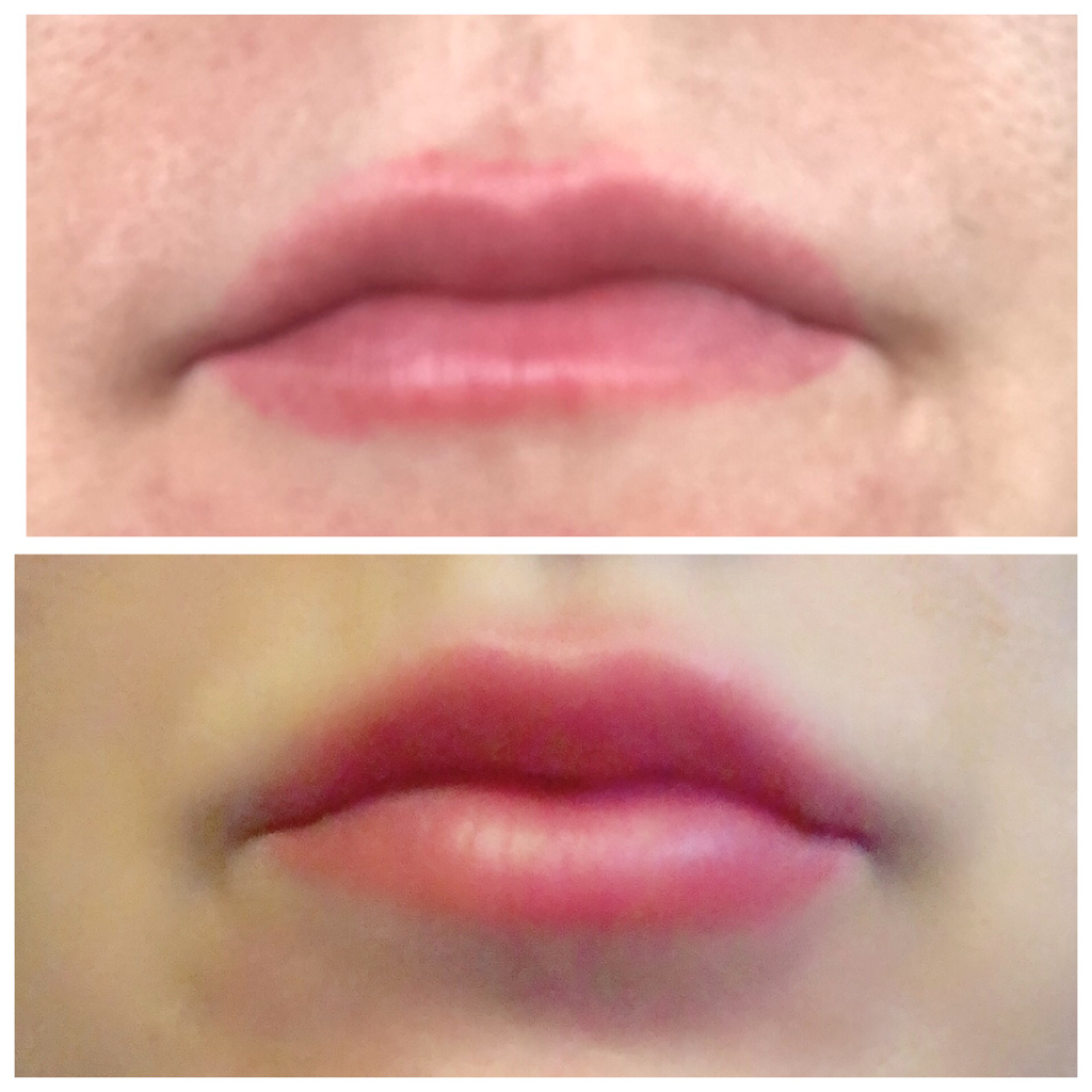 Ageless Medical Cosmetic Clinic | 1100 Dundas St W unit 1, Mississauga, ON L5C 4E7, Canada | Phone: (647) 951-5392