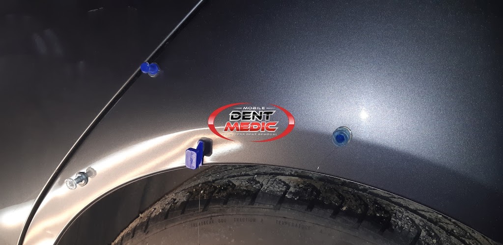 Mobile Dent Medic | 179 Bleecker St, Toronto, ON M4X 1L9, Canada | Phone: (416) 861-0425