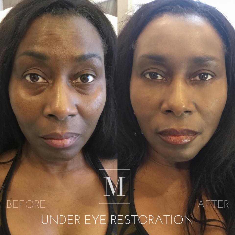 Monaco Medical Aesthetics | 80 King St E, Stoney Creek, ON L8G 1K2, Canada | Phone: (905) 921-4940