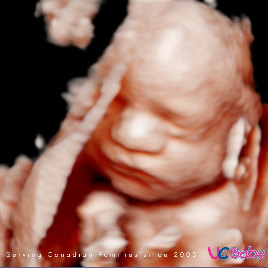 UC Baby 3D Ultrasound | 536 Laura Ave, Suite 203 Liberty Park Professional Center, Red Deer, AB T4E 0A5, Canada | Phone: (877) 682-2229