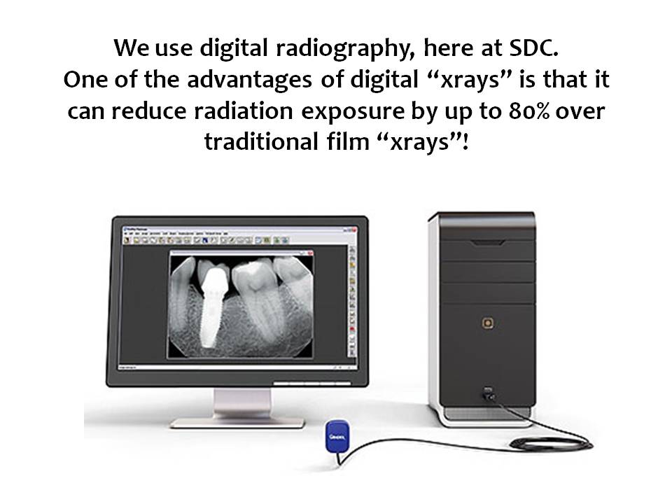 Springfield Dental Centre | 2149 Springfield Rd #100, Kelowna, BC V1Y 7X1, Canada | Phone: (250) 860-5151