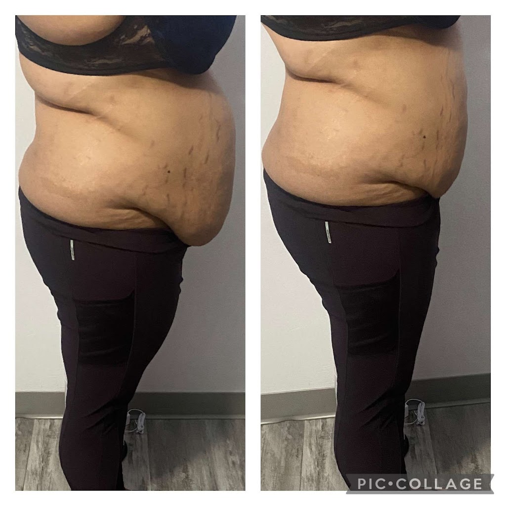 Precise Body Lab | 31125 Kingfisher Dr, Abbotsford, BC V2T 5K4, Canada | Phone: (778) 345-5345