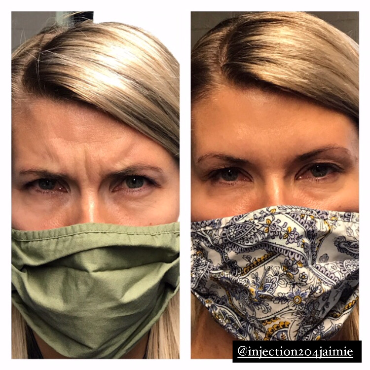 Injection204jaimie | 160 Provencher Blvd #101, Winnipeg, MB R2H 0G3, Canada | Phone: (204) 925-9779