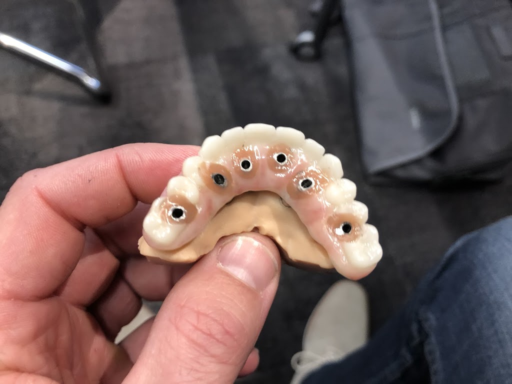 Kasper Denture clinic ltd | 1710 Ellis St Suite 25, Kelowna, BC V1W 3S9, Canada | Phone: (250) 717-3730
