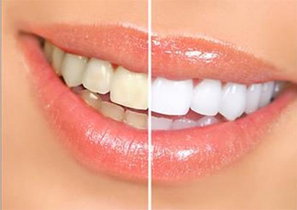 Simcoe Muskoka Dental Hygiene | 67 Red Oak Dr #101, Barrie, ON L4N 9M5, Canada | Phone: (705) 321-1871