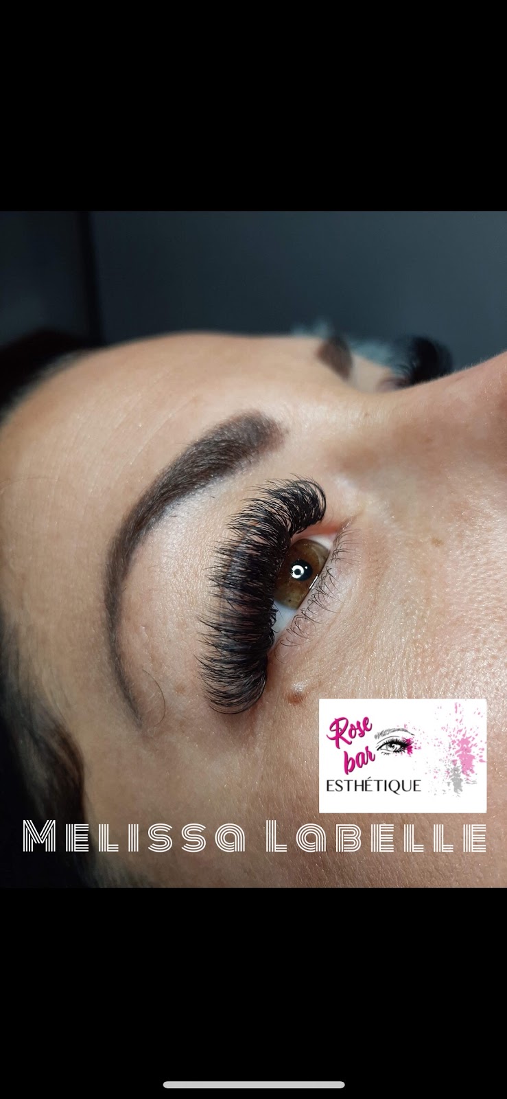 Rose Bar Esthétique | 3161C Bd Dagenais O, Laval, QC H7P 1T8, Canada | Phone: (514) 578-0456