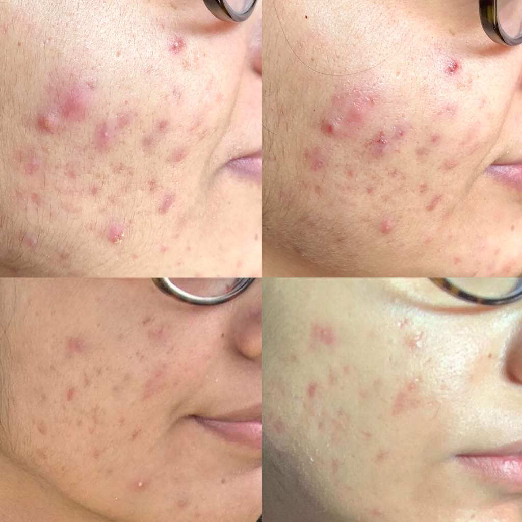 Reesha- Customized Facials & Skincare | 2766 Langlois Ct, Windsor, ON N8X 4T8, Canada | Phone: (519) 984-4786