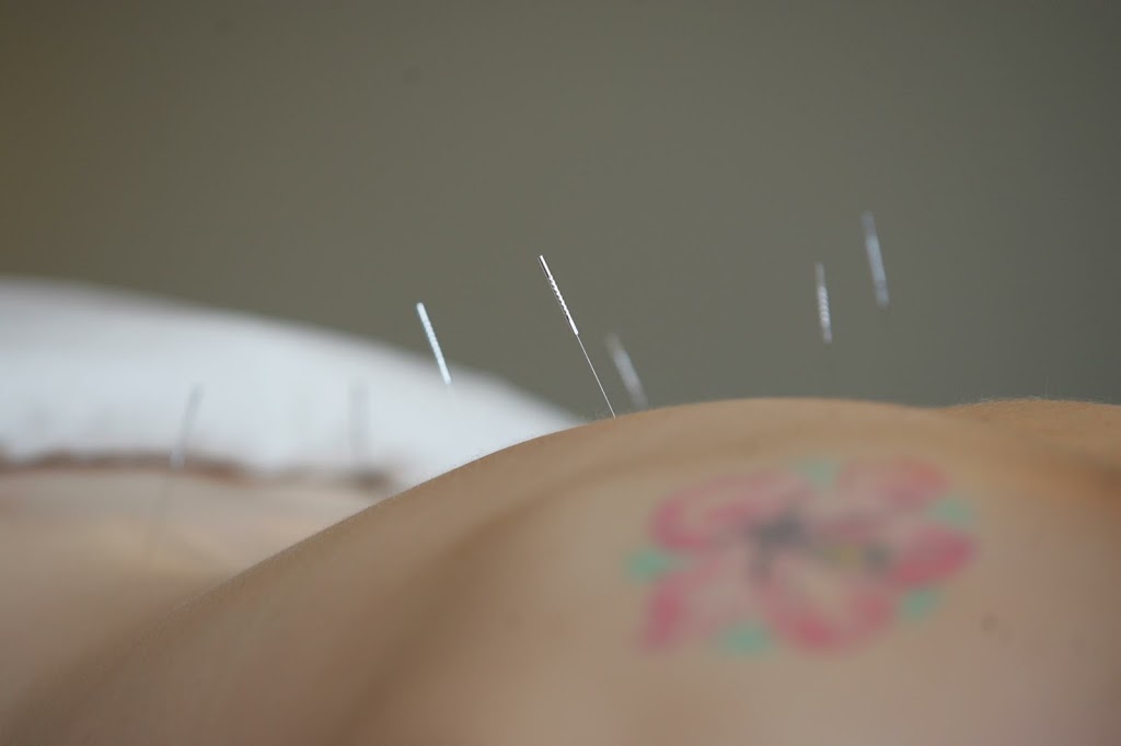 Embrace Acupuncture | 312 Fifth Ave, Cochrane, AB T4C 2A7, Canada | Phone: (403) 678-7970